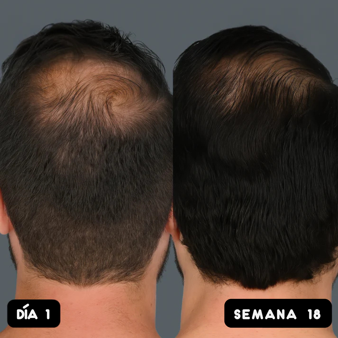 Aceite de Semilla de Calabaza Solaví