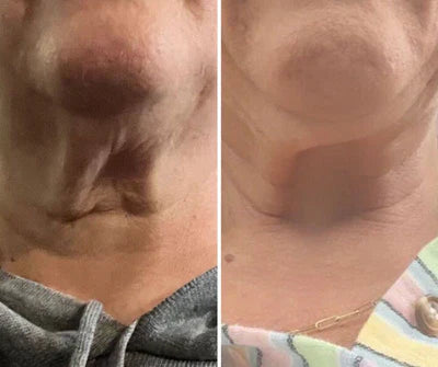 Crema para cuello - Antiedad