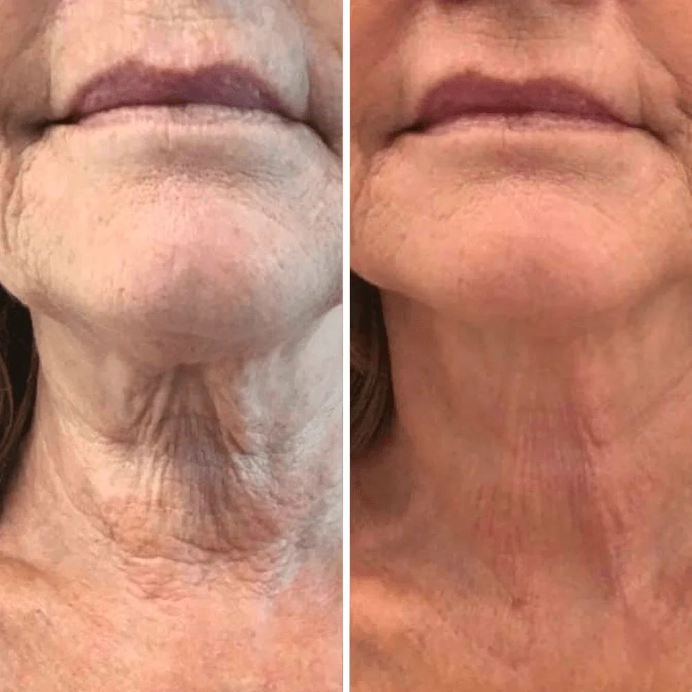 Crema para cuello - Antiedad