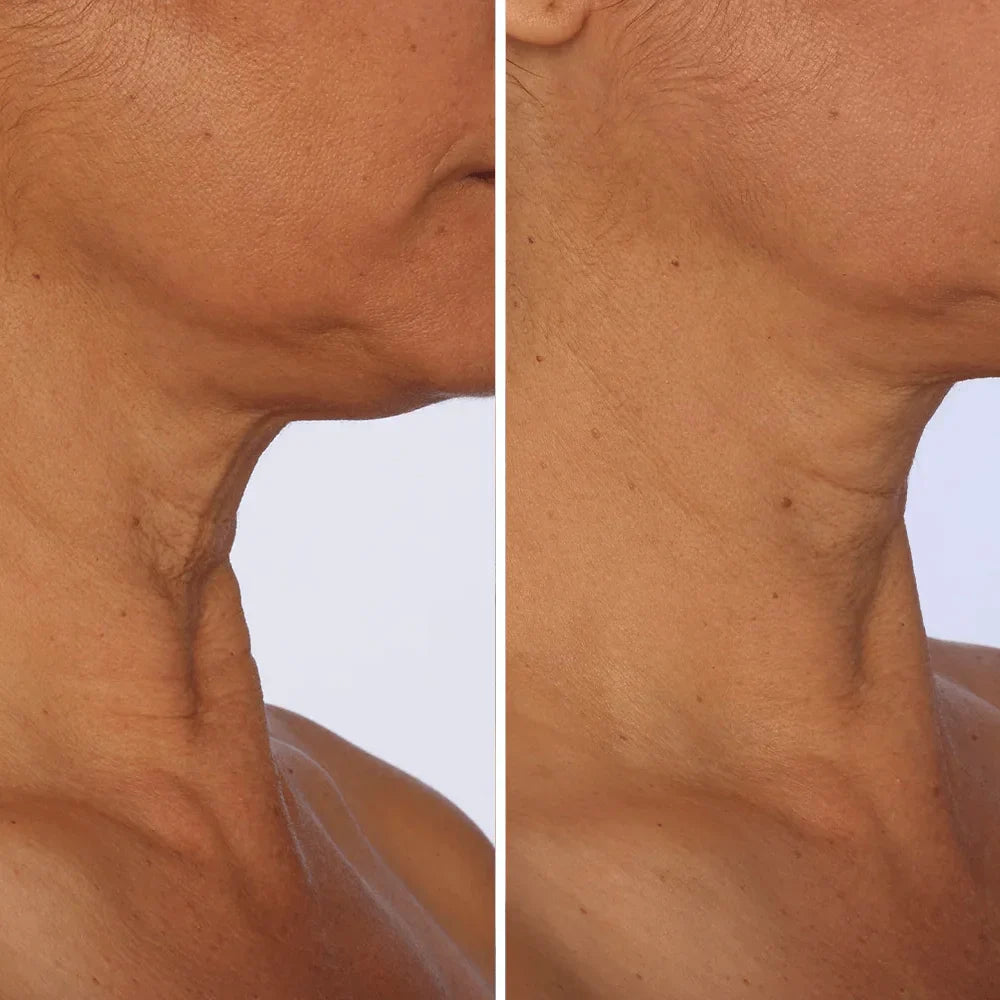 Crema para cuello - Antiedad