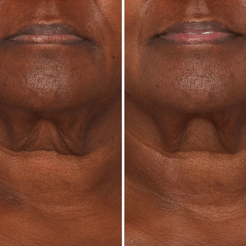Crema para cuello - Antiedad