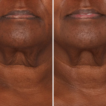 Crema para cuello - Antiedad