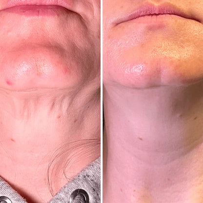 Crema para cuello - Antiedad