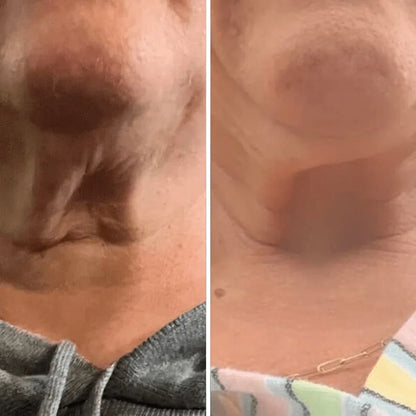 Crema para cuello - Antiedad