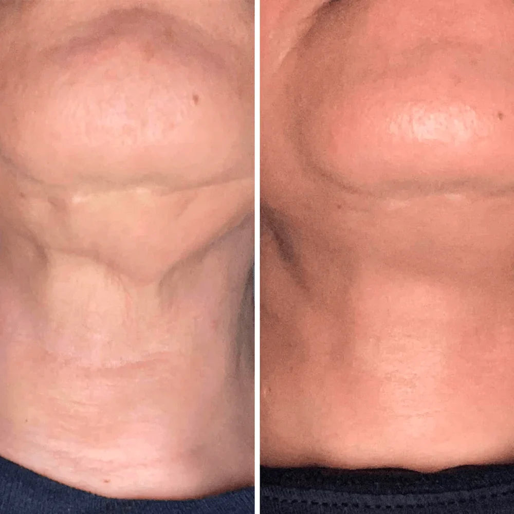 Crema para cuello - Antiedad