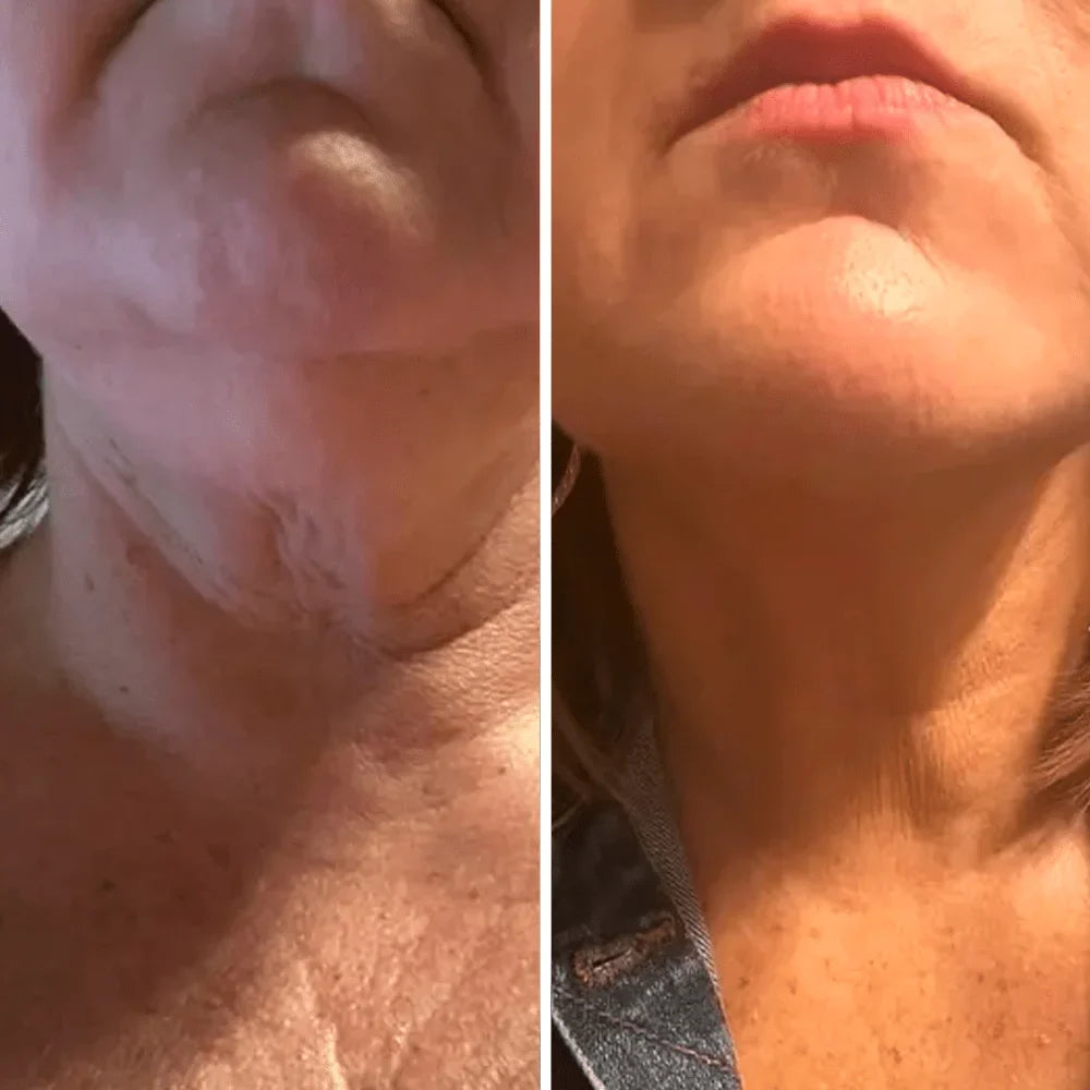 Crema para cuello - Antiedad