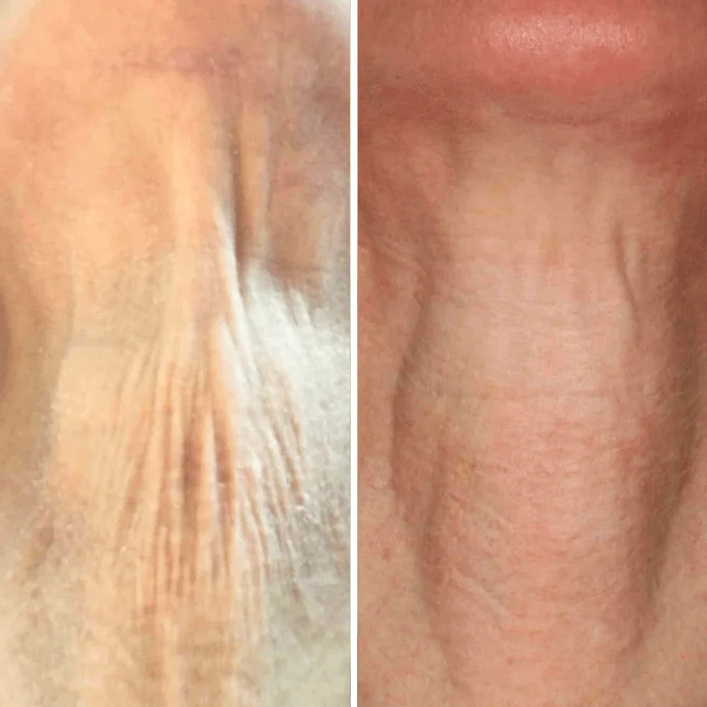 Crema para cuello - Antiedad