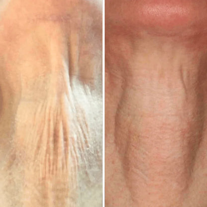Crema para cuello - Antiedad