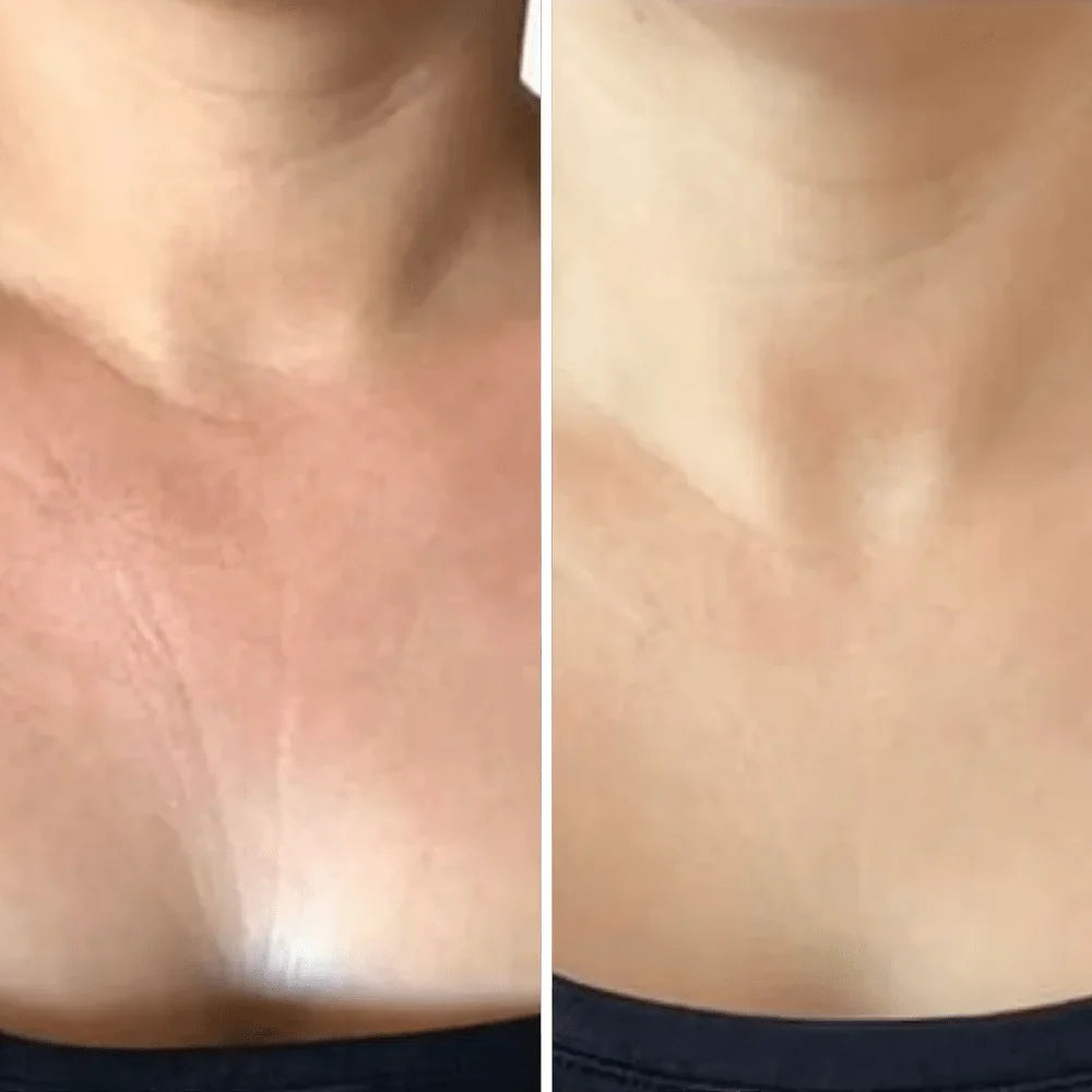 Crema para cuello - Antiedad