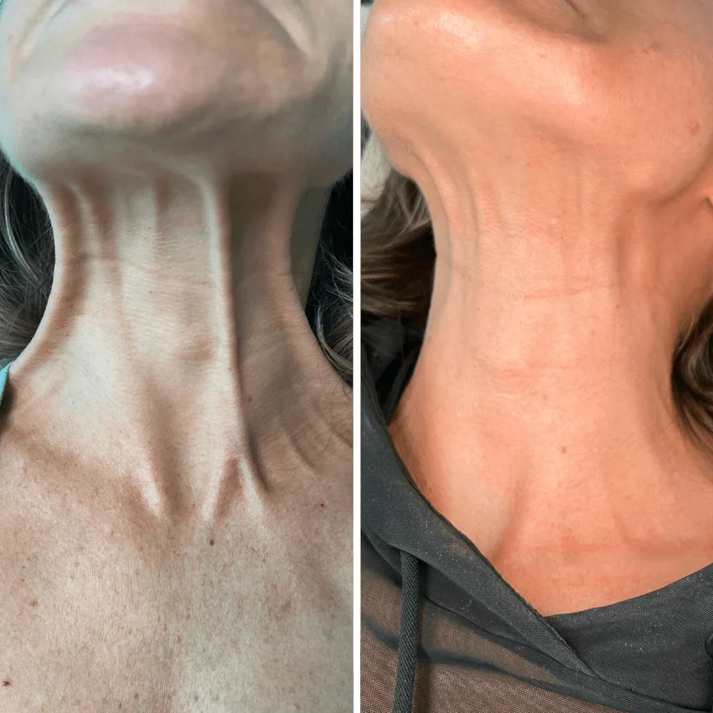 Crema para cuello - Antiedad