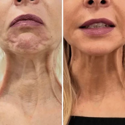 Crema para cuello - Antiedad