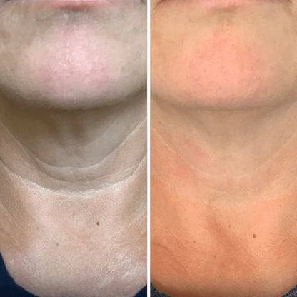 Crema para cuello - Antiedad