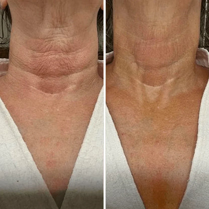 Crema para cuello - Antiedad