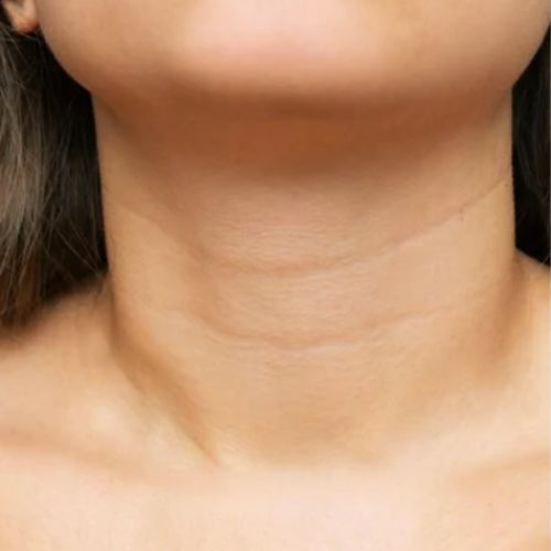 Crema para cuello - Antiedad