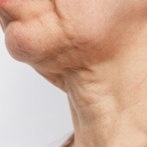 Crema para cuello - Antiedad