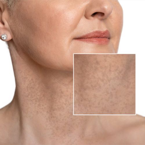 Crema para cuello - Antiedad