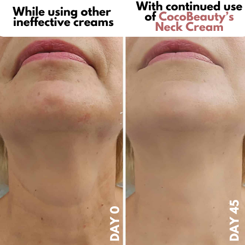 Crema para cuello - Antiedad