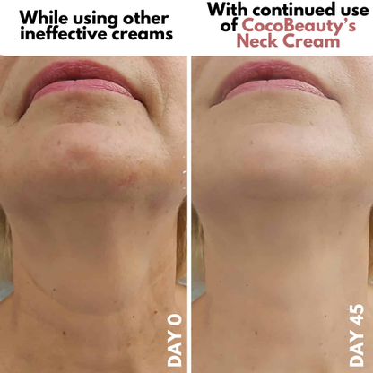 Crema para cuello - Antiedad