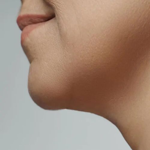Crema para cuello - Antiedad