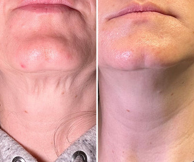 Crema para cuello - Antiedad