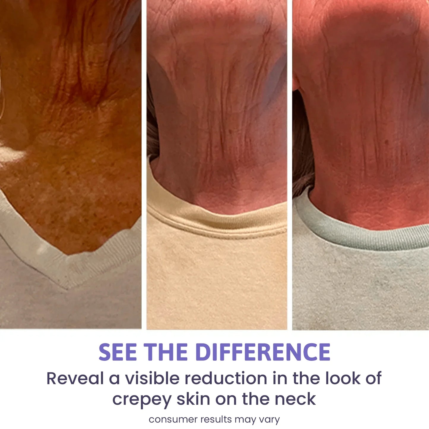 Crema para cuello - Antiedad