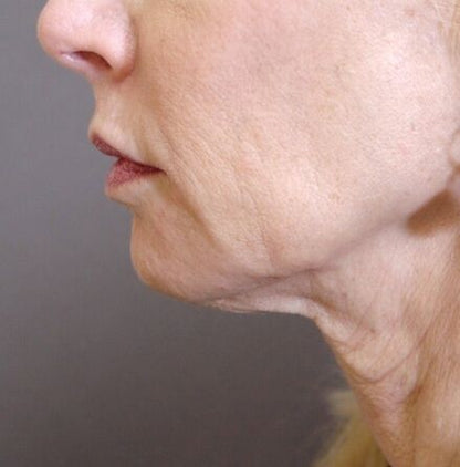 Crema para cuello - Antiedad